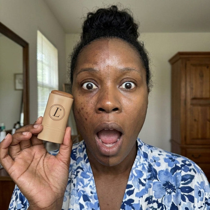 Dark spots & hyperpigmentation